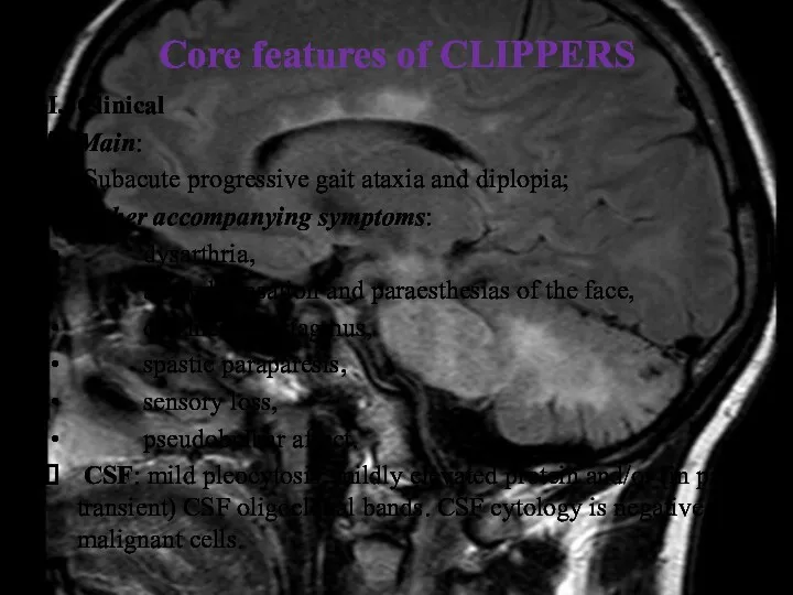 Core features of CLIPPERS I. Clinical Main: Subacute progressive gait
