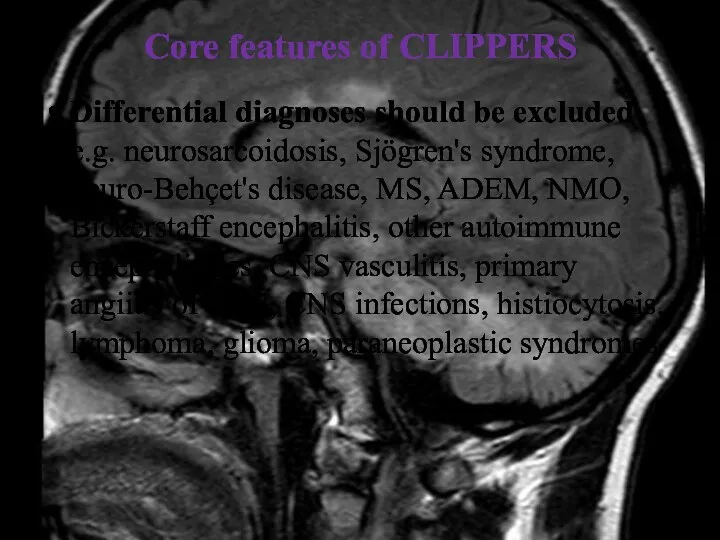 Core features of CLIPPERS Differential diagnoses should be excluded e.g. neurosarcoidosis, Sjögren's syndrome,