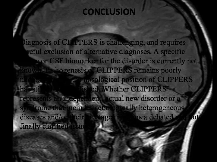 CONCLUSION Diagnosis of CLIPPERS is challenging, and requires careful exclusion of alternative diagnoses.
