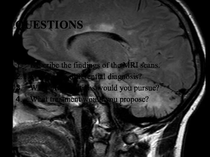 QUESTIONS Describe the findings of the MRI scans. What is the differential diagnosis?