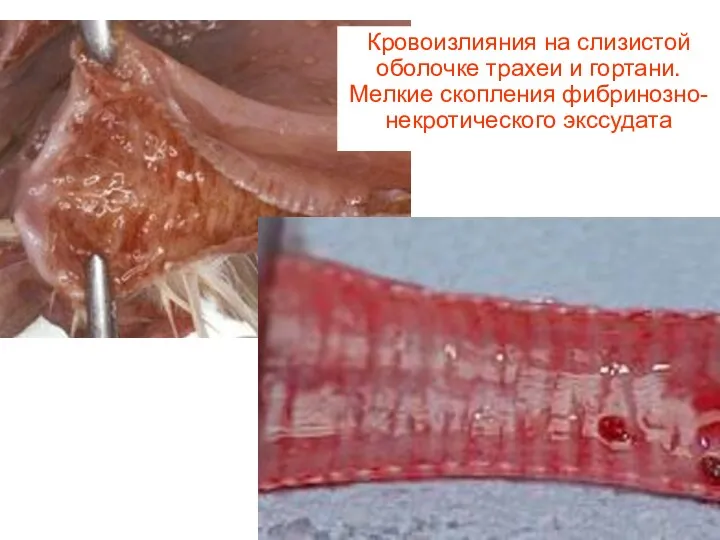 Кровоизлияния на слизистой оболочке трахеи и гортани. Мелкие скопления фибринозно-некротического экссудата