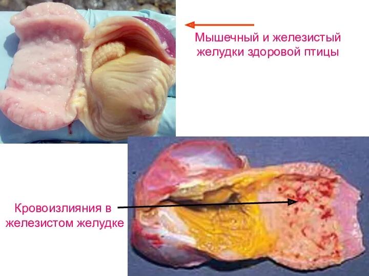 Мышечный и железистый желудки здоровой птицы Кровоизлияния в железистом желудке