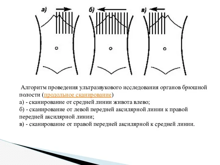 Алгоритм проведения ультразвукового исследования органов брюшной полости (продольное сканирование) а)