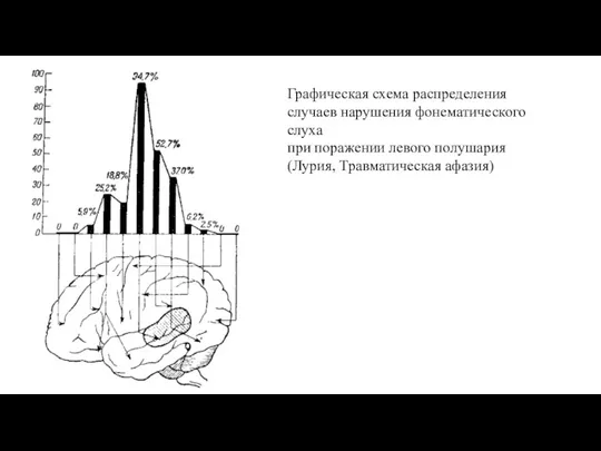 Графическая схема распределения случаев нарушения фонематического слуха при поражении левого полушария (Лурия, Травматическая афазия)