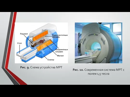 Рис. 9. Схема устройства МРТ Рис. 10. Современная система МРТ с полем 1,5 тесла