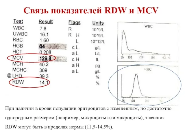 Связь показателей RDW и MCV При наличии в крови популяции