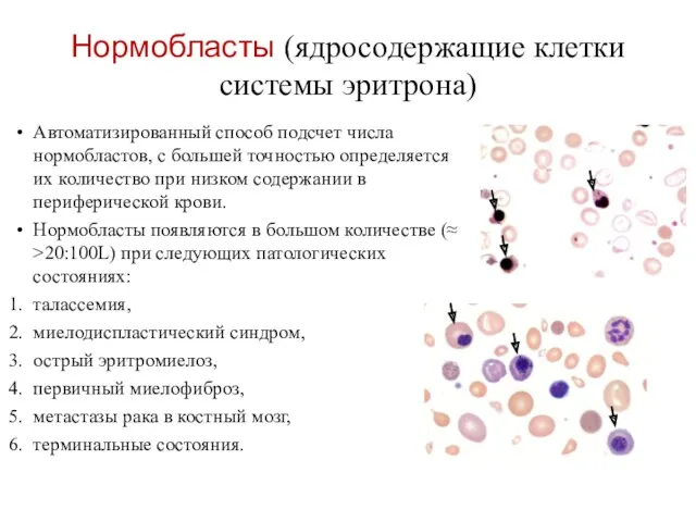 Нормобласты (ядросодержащие клетки системы эритрона) Автоматизированный способ подсчет числа нормобластов,