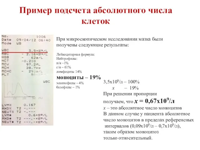 Пример подсчета абсолютного числа клеток При микроскопическом исследовании мазка были