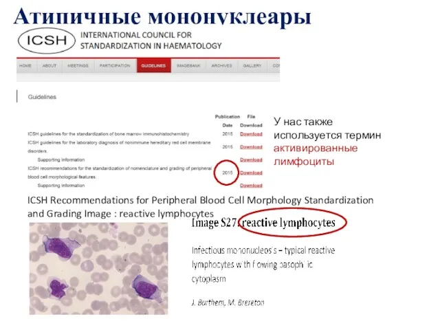 Атипичные мононуклеары ICSH Recommendations for Peripheral Blood Cell Morphology Standardization