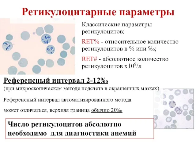 Ретикулоцитарные параметры Классические параметры ретикулоцитов: RET% - относительное количество ретикулоцитов