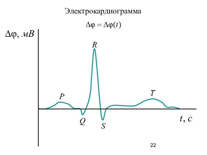 Электрокардиограмма