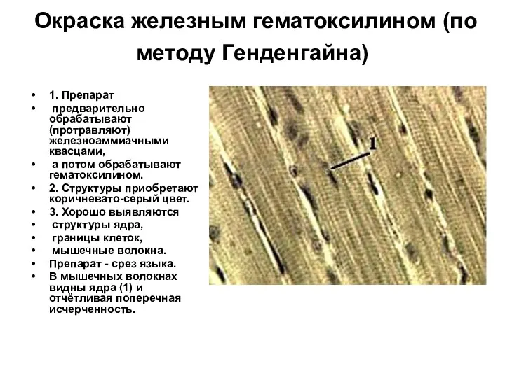 Окраска железным гематоксилином (по методу Генденгайна) 1. Препарат предварительно обрабатывают