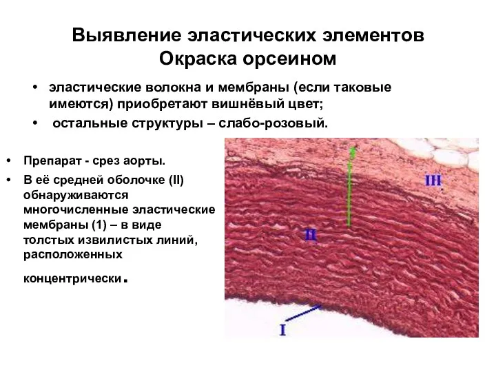 Выявление эластических элементов Окраска орсеином эластические волокна и мембраны (если