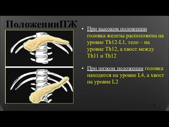 ПоложенииПЖ При высоком положении головка железы расположена на уровне Th12-L1,