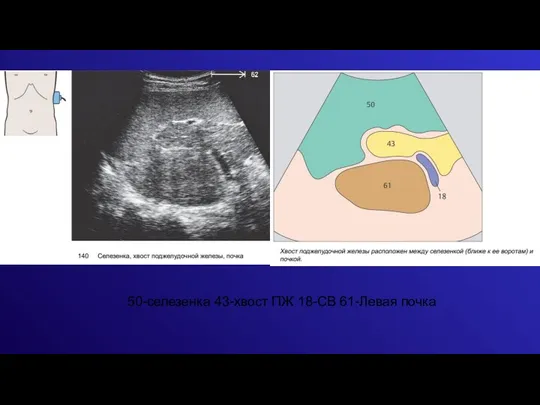 50-селезенка 43-хвост ПЖ 18-СВ 61-Левая почка