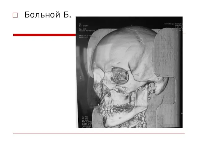 Больной Б.