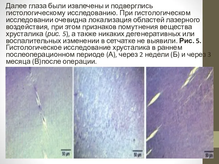 Далее глаза были извлечены и подверглись гистологическому исследованию. При гистологическом