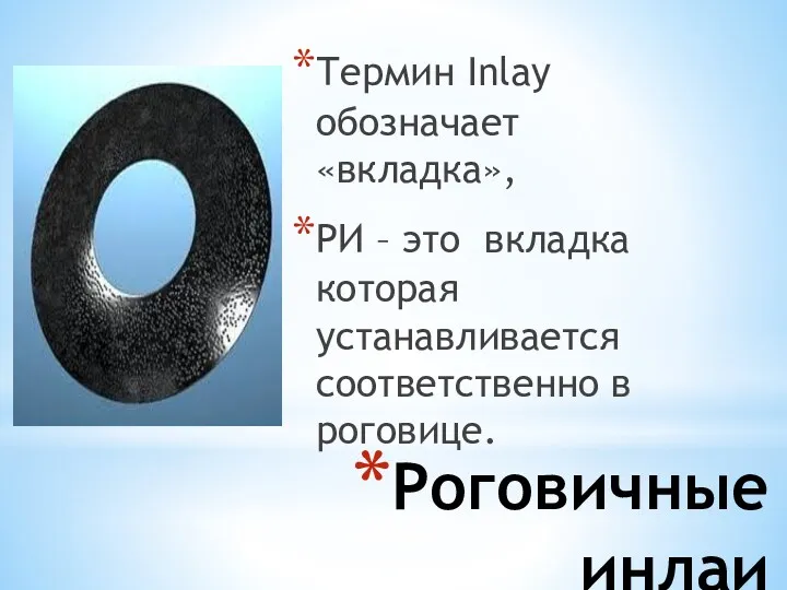 Роговичные инлаи Термин Inlay обозначает «вкладка», РИ – это вкладка которая устанавливается соответственно в роговице.