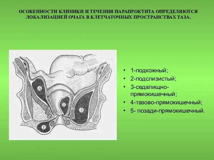 ОСОБЕННОСТИ КЛИНИКИ И ТЕЧЕНИЯ ПАРАПРОКТИТА ОПРЕДЕЛЯЮТСЯ ЛОКАЛИЗАЦИЕЙ ОЧАГА В КЛЕТЧАТОЧНЫХ