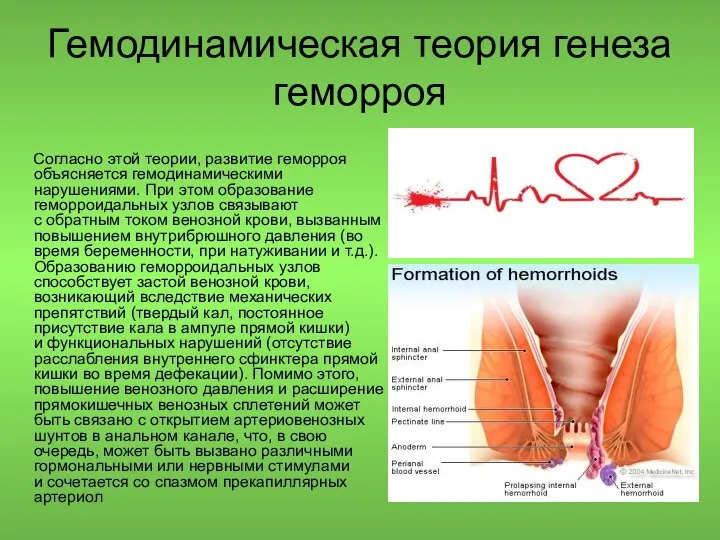 Гемодинамическая теория генеза геморроя Согласно этой теории, развитие геморроя объясняется