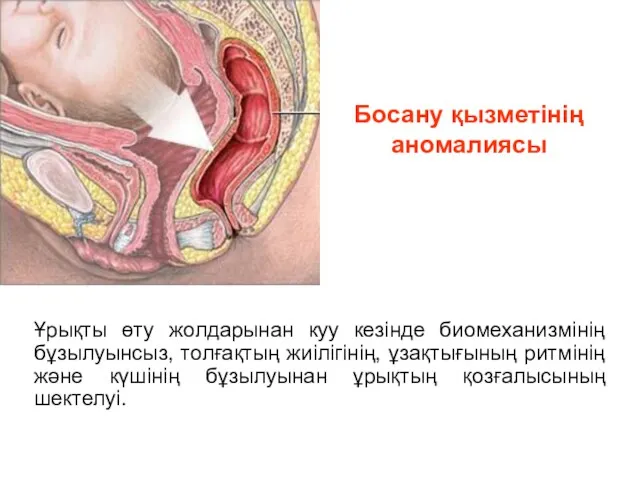 Босану қызметінің аномалиясы Ұрықты өту жолдарынан куу кезінде биомеханизмінің бұзылуынсыз,