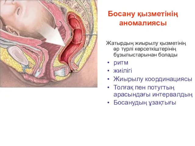 Босану қызметінің аномалиясы Жатырдың жиырылу қызметінің әр түрлі көрсеткіштерінің бұзылыстарынан болады ритм жиілігі