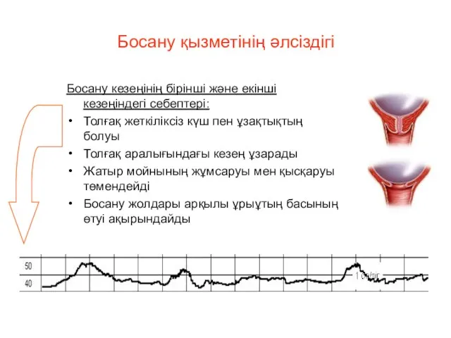 Босану қызметінің әлсіздігі Босану кезеңінің бірінші және екінші кезеңіндегі себептері: