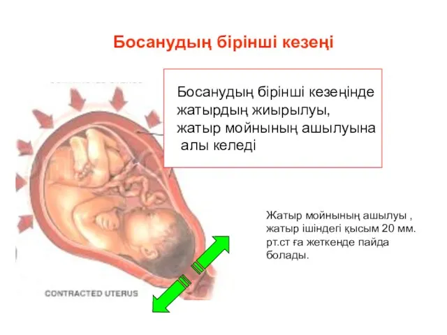 Босанудың бірінші кезеңі Босанудың бірінші кезеңінде жатырдың жиырылуы, жатыр мойнының ашылуына алы келеді