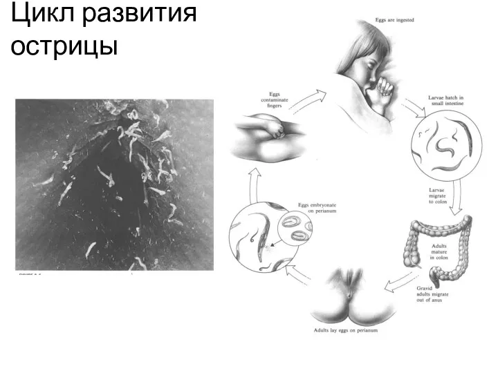 Цикл развития острицы