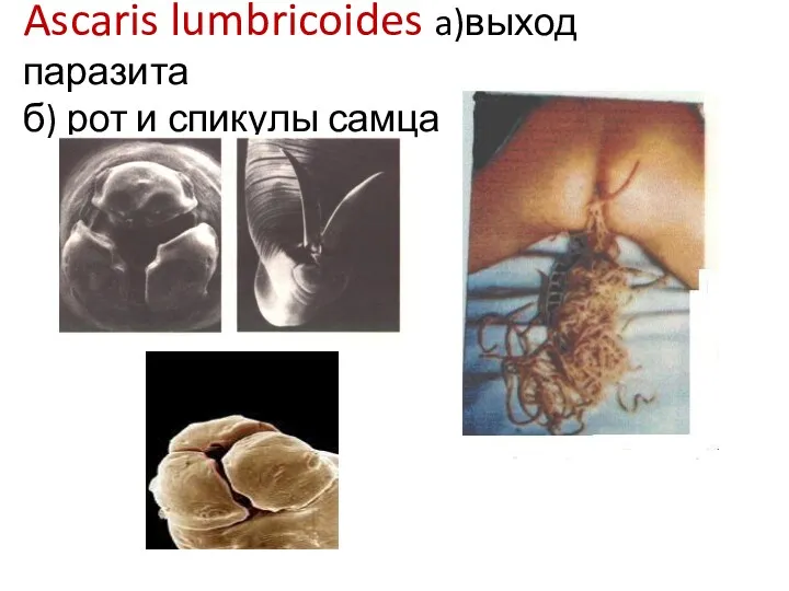 Ascaris lumbricoides a)выход паразита б) рот и спикулы самца