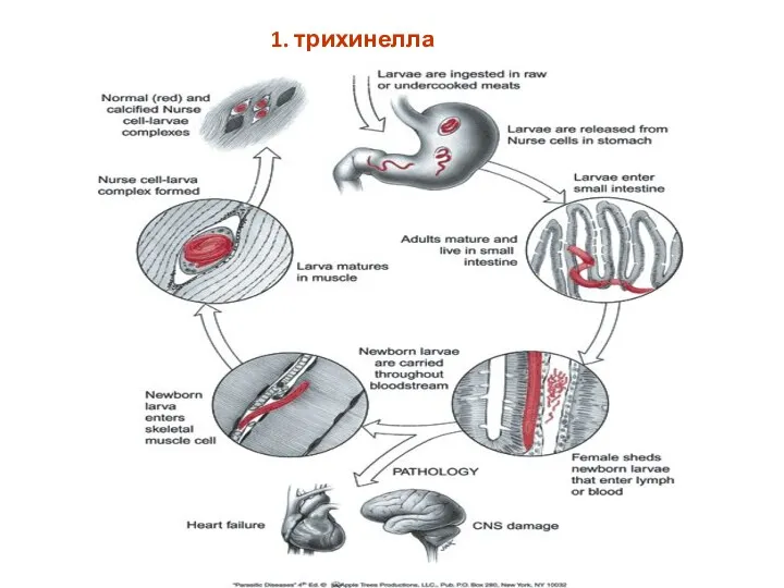 1. трихинелла