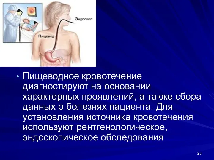 Пищеводное кровотечение диагностируют на основании характерных проявлений, а также сбора