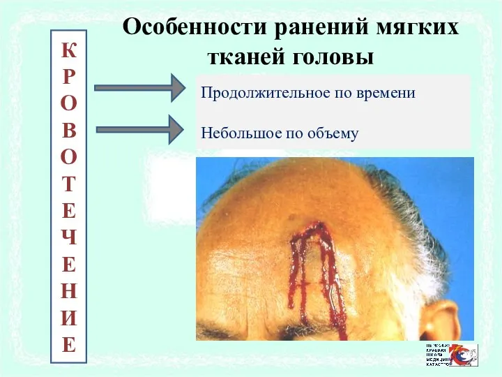 Особенности ранений мягких тканей головы К РОВО Т Е Ч