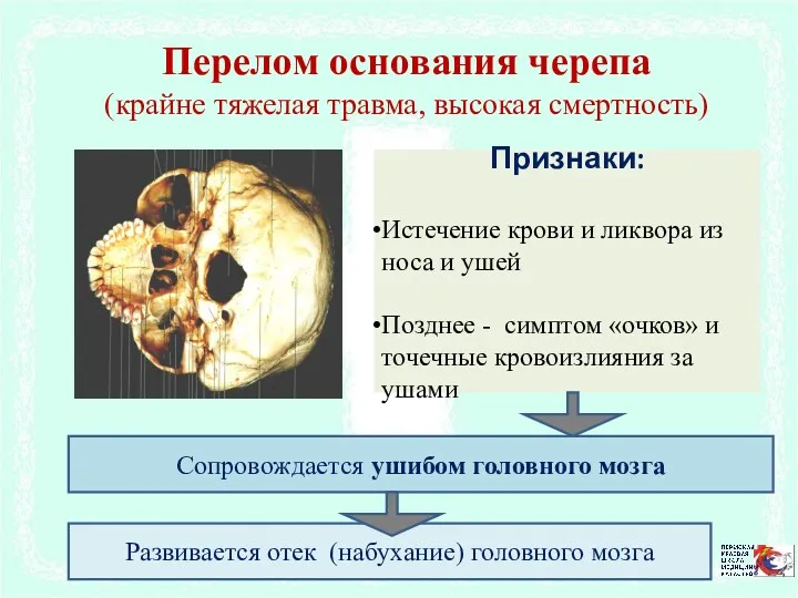 Перелом основания черепа (крайне тяжелая травма, высокая смертность) Признаки: Истечение
