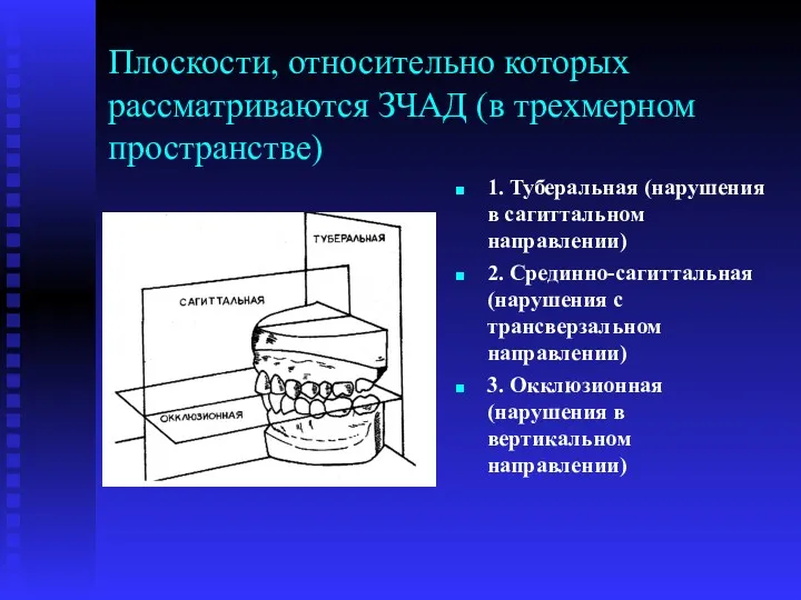 Плоскости, относительно которых рассматриваются ЗЧАД (в трехмерном пространстве) 1. Туберальная