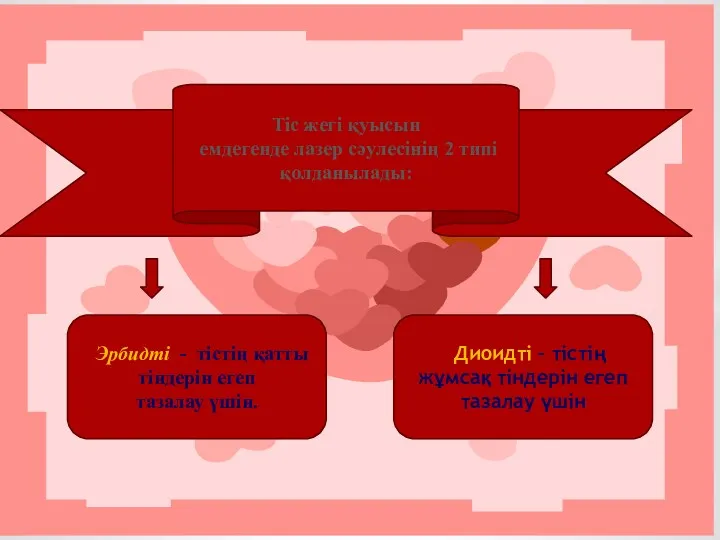 Тіс жегі қуысын емдегенде лазер сәулесінің 2 типі қолданылады: Эрбидті