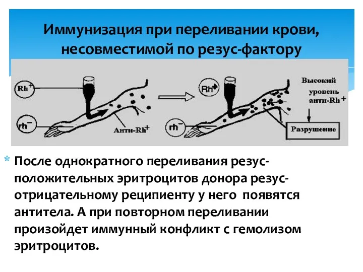 Иммунизация при переливании крови, несовместимой по резус-фактору После однократного переливания