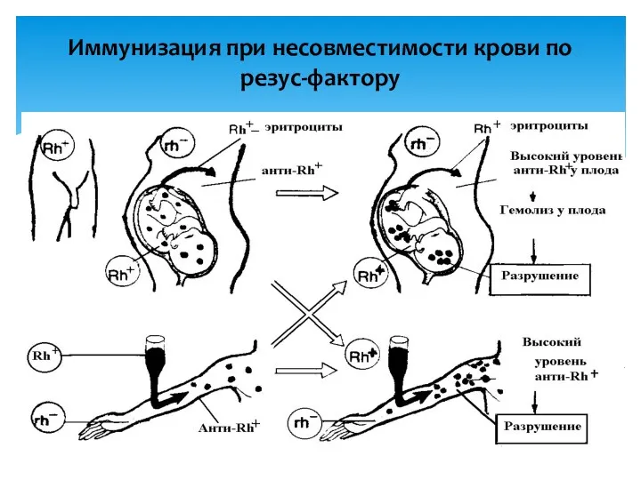 Иммунизация при несовместимости крови по резус-фактору