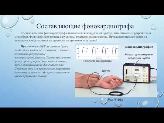 Составляющие фонокардиографа Составляющими фонокардиографа являются анализирующий прибор, записывающее устройство и