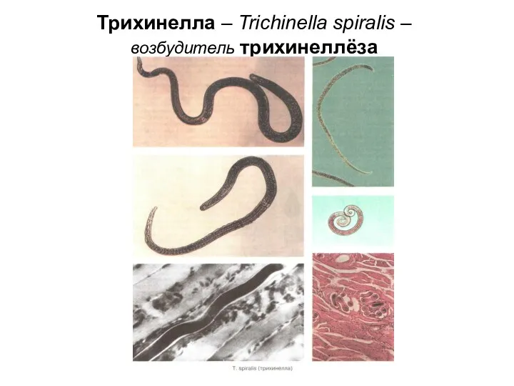 Трихинелла – Trichinella spiralis – возбудитель трихинеллёза