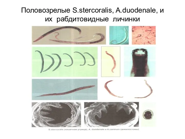 Половозрелые S.stercoralis, A.duodenale, и их рабдитовидные личинки