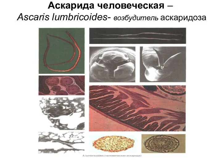 Аскарида человеческая – Ascaris lumbricoides- возбудитель аскаридоза