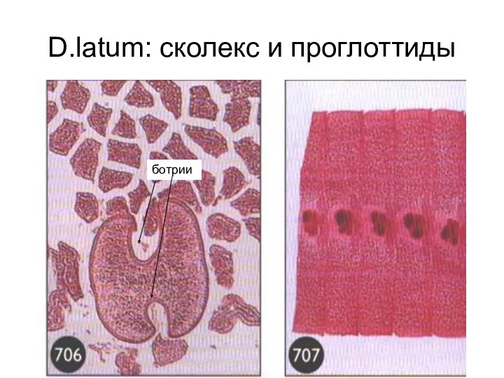 D.latum: сколекс и проглоттиды ботрии