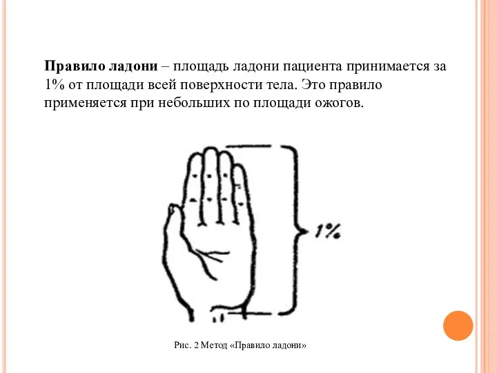 Правило ладони – площадь ладони пациента принимается за 1% от