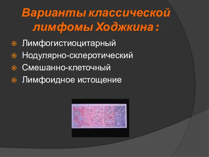 Варианты классической лимфомы Ходжкина : Лимфогистиоцитарный Нодулярно-склеротический Смешанно-клеточный Лимфоидное истощение