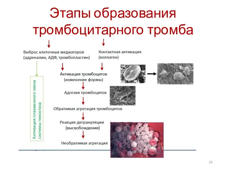 Этапы образования тромбоцитарного тромба