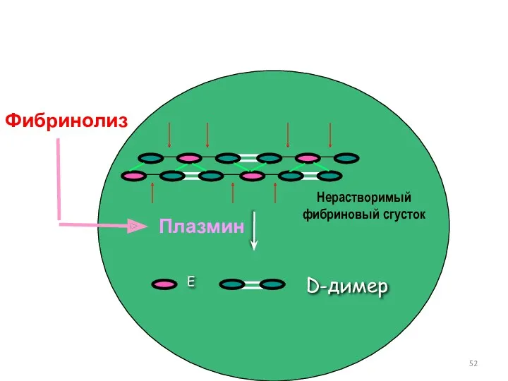 D-димер E Конечный продукт фибринолиза – D-димер Фибринолиз Нерастворимый фибриновый сгусток Плазмин