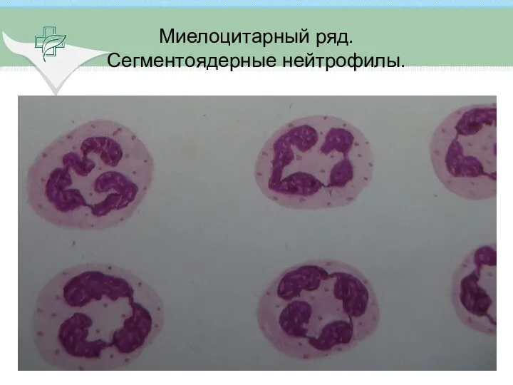 Миелоцитарный ряд. Сегментоядерные нейтрофилы.