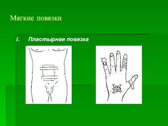 Мягкие повязки Пластырная повязка