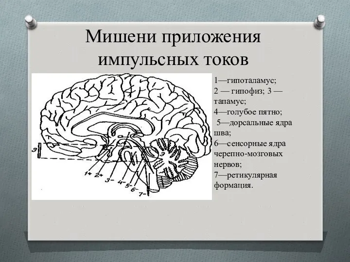 Мишени приложения импульсных токов 1—гипоталамус; 2 — гипофиз; 3 —